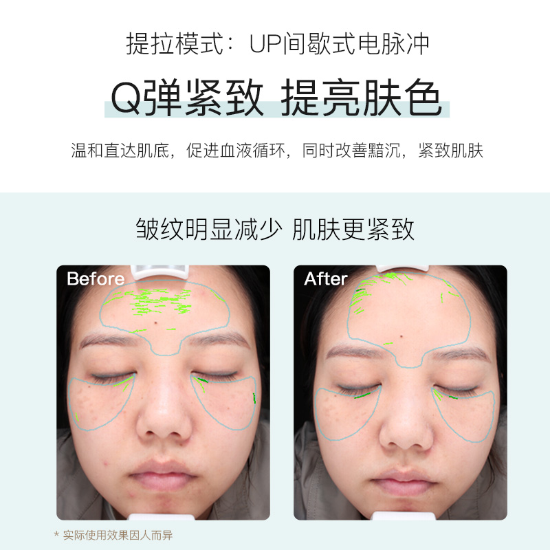 JUJY纪芝蜜养嫩肤仪